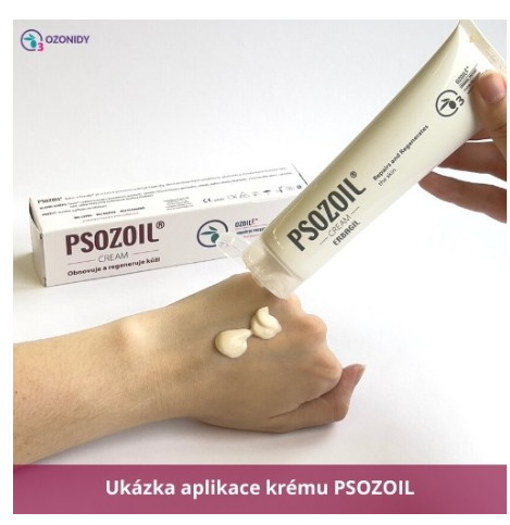 PSOZOIL Krém na lupénku 100 ml 